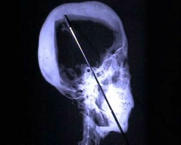 Sch&auml;del des Tut-Ench-Amun